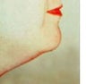 Liposuction of the neck