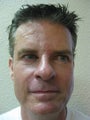 Laser Resurfacing