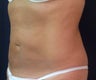 Smart Water Lipo