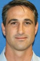 Rhinoplasty