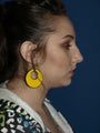 Rhinoplasty