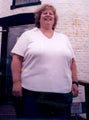 Gastric Bypass