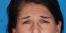Botox