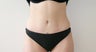 Tummy Tuck