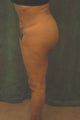 Women's Buttocks Augmentation 