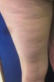 Cellulaze