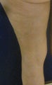 Cellulaze