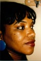 Rhinoplasty