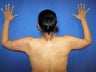 Arm Lift Surgery
