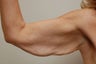 arm tuck