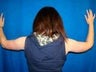 Arm Lift