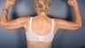 Brachioplasty 