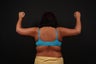Arm Lift
