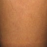 Asclera