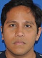 Rhinoplasty-Asian