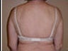 Body Jet
