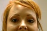 Botox