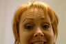 Botox
