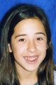 Braces
