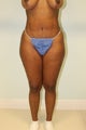 Brazilian that lift