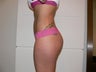 Brazilian Butt Lift