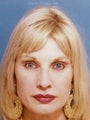 Endoscopic Browlift