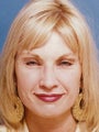  Endoscopic Browlift 