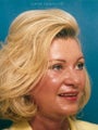 Endoscopic brow lift and lower blepharoplasty with full face erbium laser resurfacing