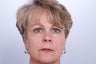 Endoscopic Brow Lift
