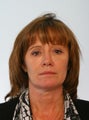 Browlift Blepharoplasty Chin Augmentation Botox  Juvederm