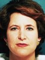  Endoscopic Browlift and Bilateral Upper Blepharoplasty 