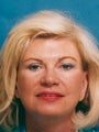 Endoscopic brow lift and lower blepharoplasty with full face erbium laser resurfacing