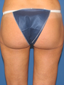 Del Mar butt tuck