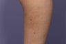 Cellulaze