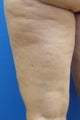 Cellulaze