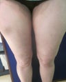 Cellulaze