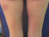 Cellulaze