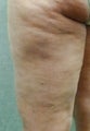 Cellulaze