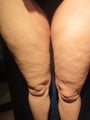 Cellulaze