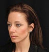 Aesthetic facial balancing