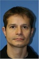 Chin Implant, Jaw Implant