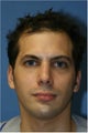 Chin Implant, Rhinoplasty, Otoplasty