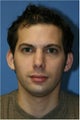 Chin Implant, Rhinoplasty, Otoplasty