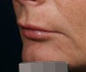 Filler
