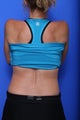 CoolSculpting 
