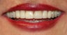 Cosmetic Dentistry