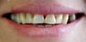 Cosmetic Dentistry