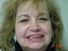 Implant supported full dentures 