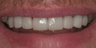 Cosmetic Dentistry