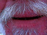 Dentures